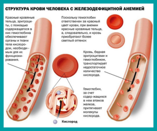 Структура клетки человека при железодефицитной анемии