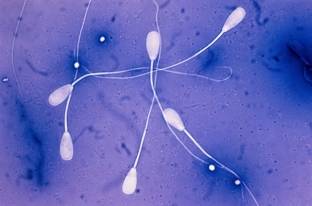 Как выглядят сперматозоиды под микроскопом